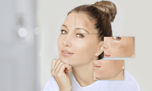 La Poderosa Alianza para una Piel Radiante: Los Beneficios del Cobre y la Plata Coloidal. En el mundo de la belleza y el cuidado de la piel, la búsqueda de ingredientes naturales y efectivos es una constante. Entre las joyas ocultas de la naturaleza se en